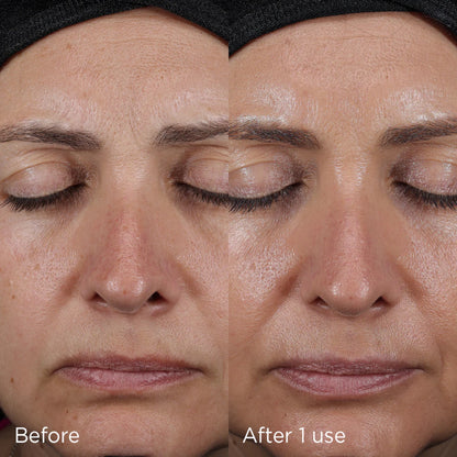 IMAGE Skincare DAILY PREVENTION Advanced Smartblend SPF 75