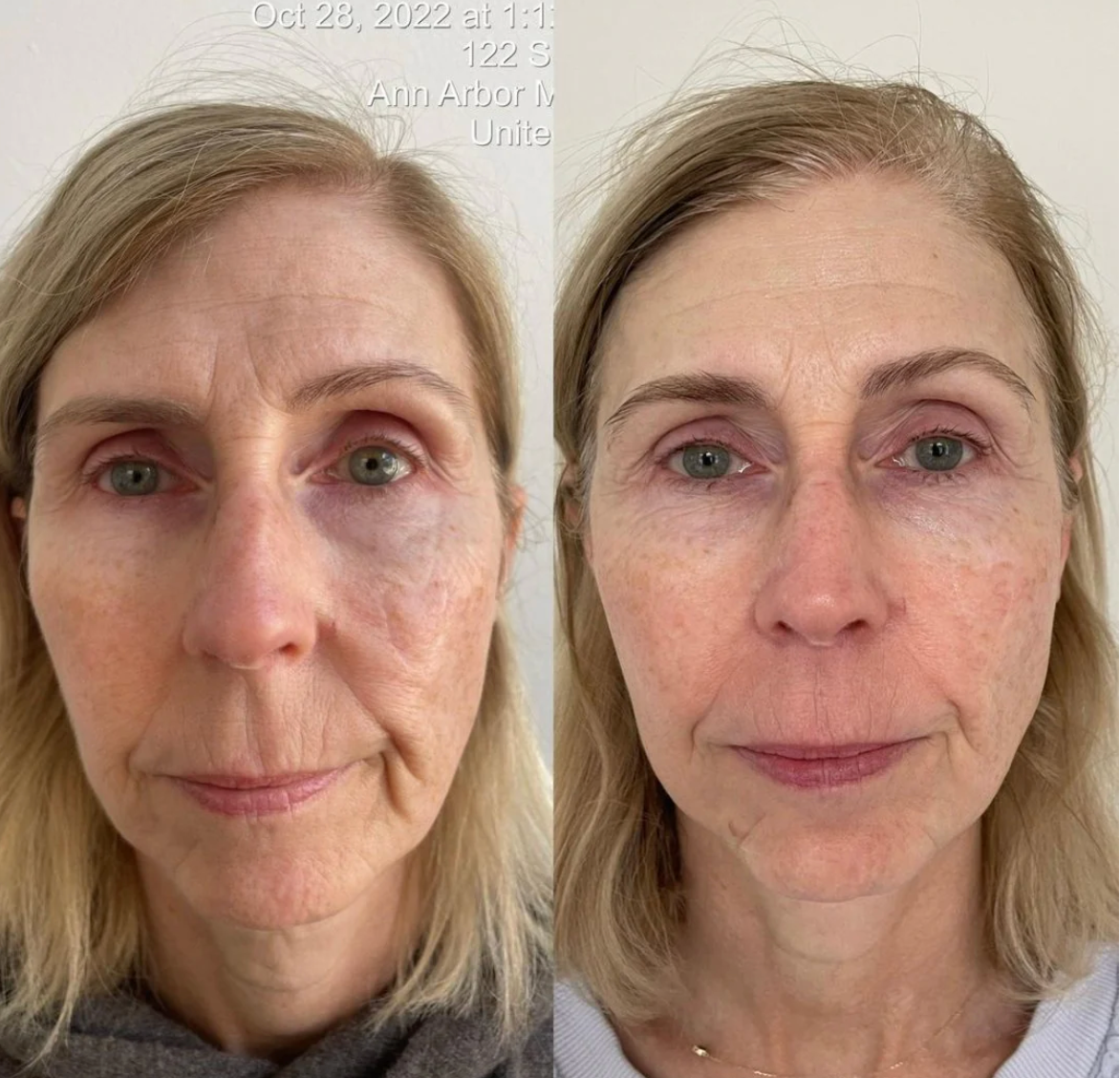 KrX Youthplex Face Lift Cleansing Fluid